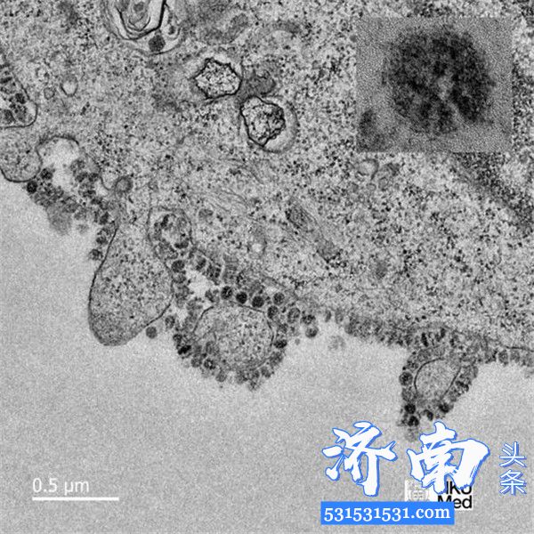 新冠病毒在电子显微镜长什么样？来看看这组图像